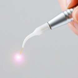 Laserbehandlung in der Parodontologie / Endodontie / Chirurgie